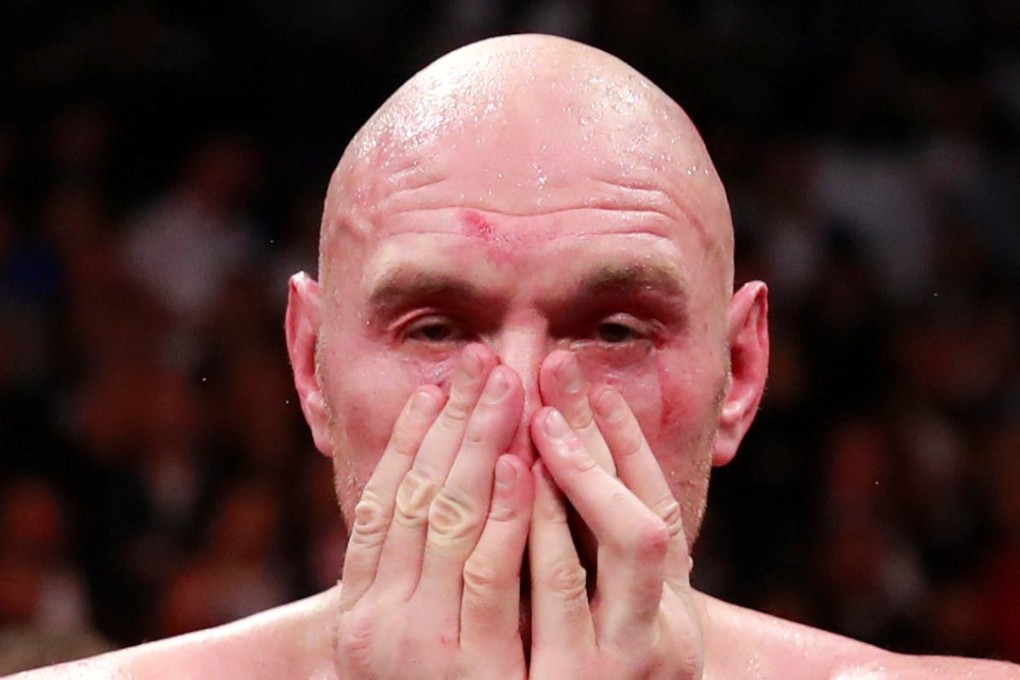 Tyson Fury after his fight with Deontay Wilder. Photo: Reuters