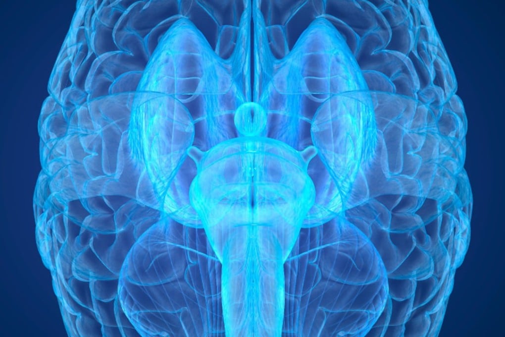 Chinese scientists are developing the world’s most powerful brain scanner. Photo: Alamy
