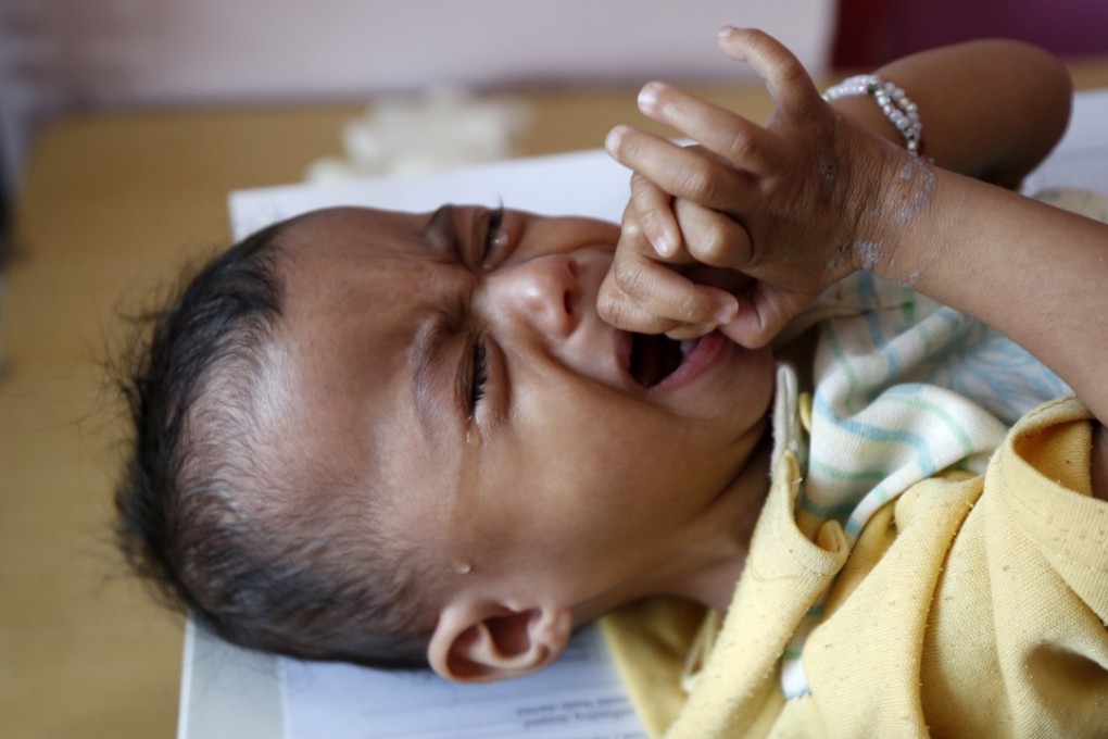 A Yemeni child receives treatment in a hospital in Sanaa. Photo: Xinhua