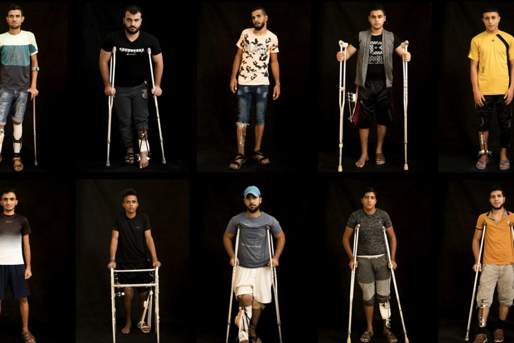 In this combination of 10 photos taken on September 19, 2018, Palestinians shot in the legs during demonstrations at the Gaza strip's border with Israel pose as they await treatment at a Gaza City clinic run by MSF (Medecins Sans Frontieres). Photo: AP Photo/Felipe Dana
