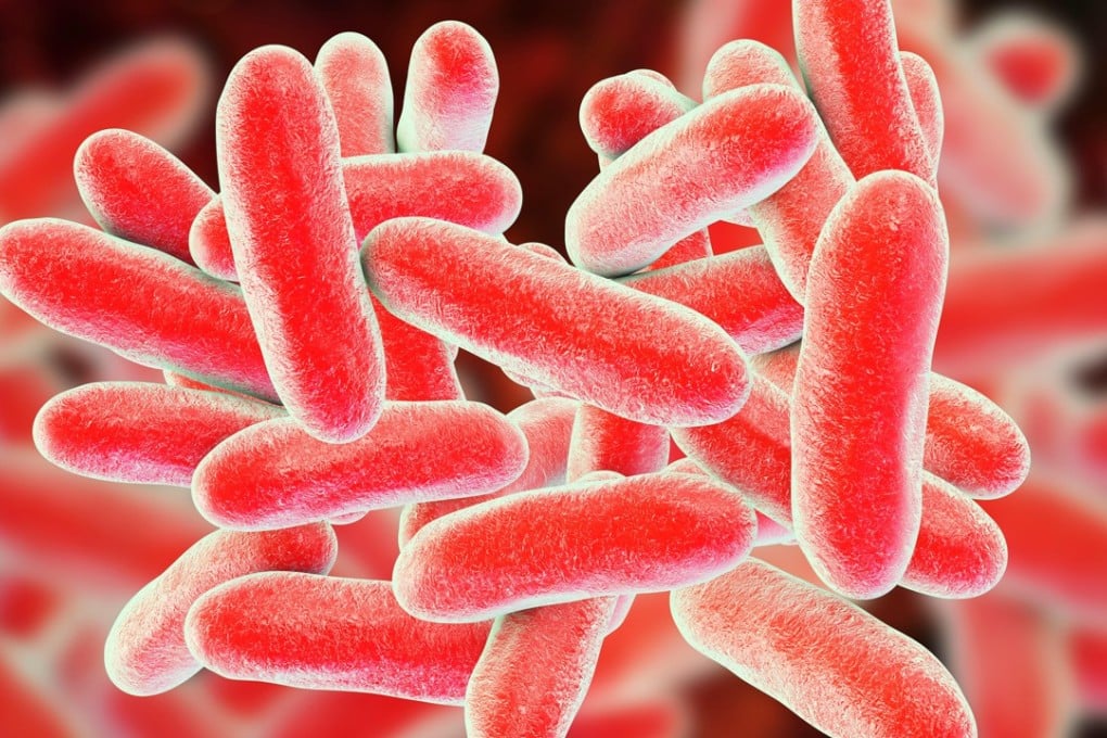 Legionnaires’ disease is caused by legionella pneumophila. Photo: Alamy