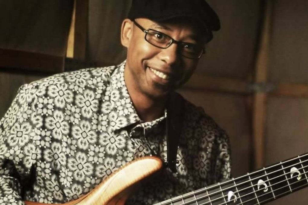 South African jazz artist Musa Manzini has played his music all over the world, but one performance stands out – strumming his guitar while surgeons operated on his brain. Photo: Facebook