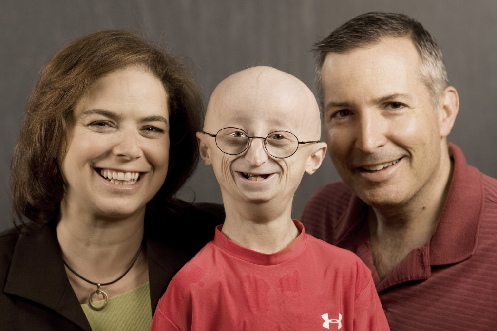 Progeria is a rare fatal disease that accelerates ageing in children. They rarely survive beyond 13 to 15 years old. Pictured is progeria sufferer Sam Berns, aged 16, and his physician parents, Drs. Leslie Gordon (left) and Scott Berns. All three appeared in the documentary Life According to Sam. Photo: HBO/MCT
