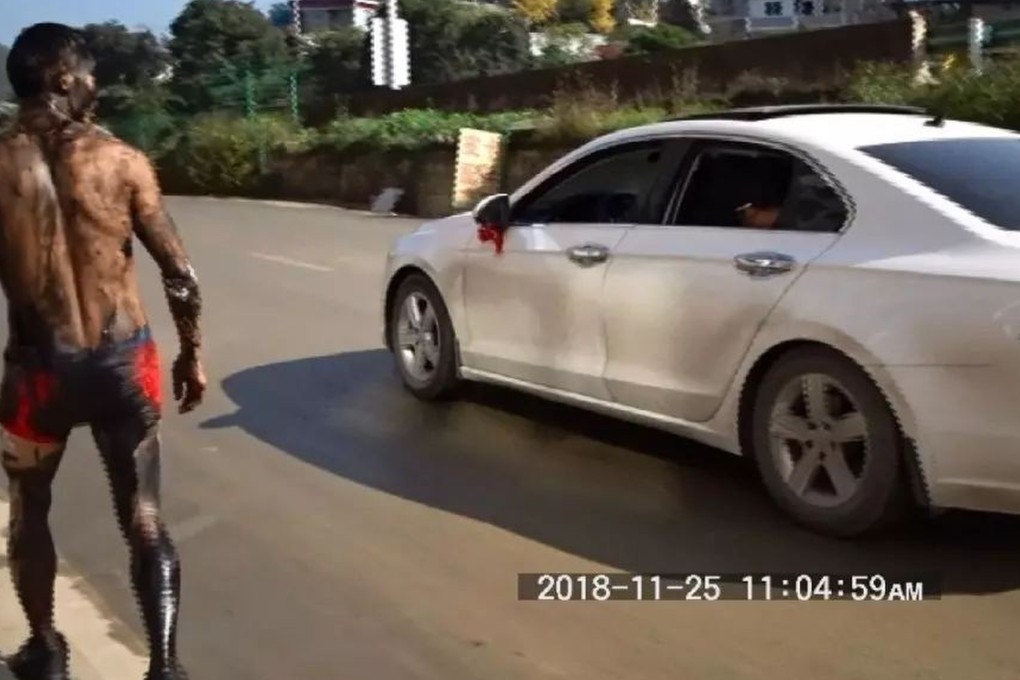 A Chinese bridegroom spent his wedding day in hospital after being hit by a car while trying to escape hazing by his friends. Photo: Sohu