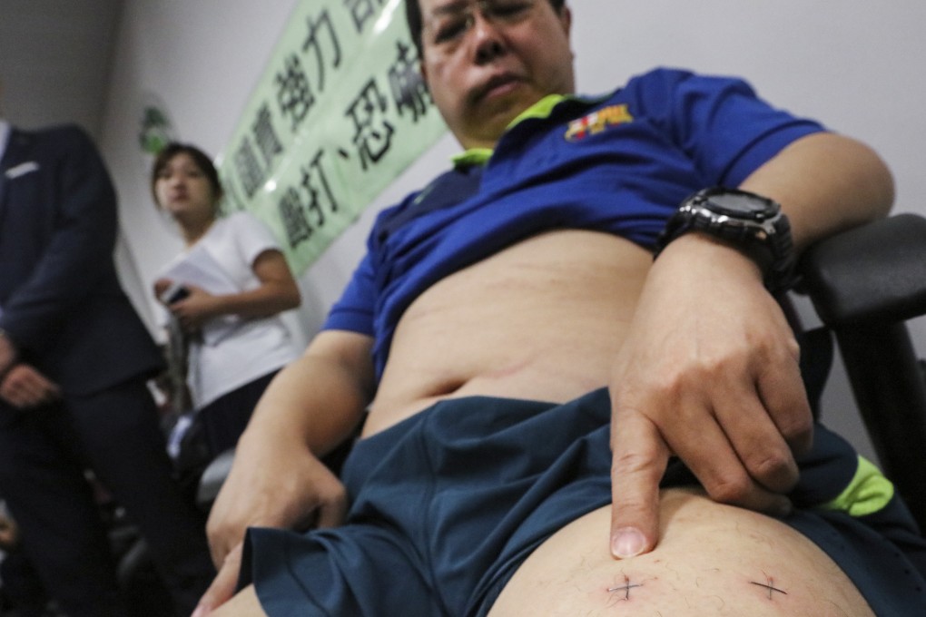 Howard Lam at a press conference in 2017 in which he claimed he was kidnapped by mainland Chinese agents and tortured with staples punched into his thighs. Photo: Felix Wong