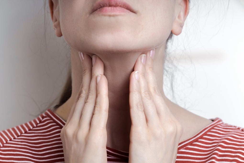 Infectious mononucleosis starts with symptoms including a sore throat and fever. Photo: Alamy