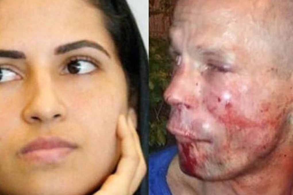 Polyana Viana posted images of the would-be robber, looking dejected and bruised. Photo: Twitter