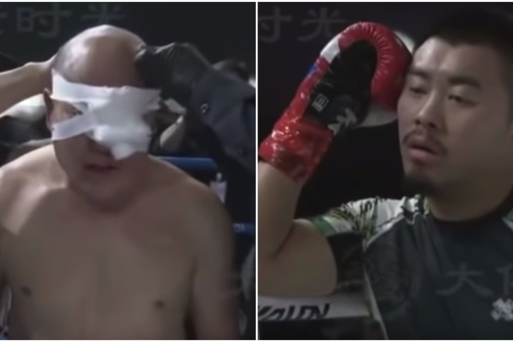 Tian Ye has his head bandaged while Xu Xiaodong mocks him by pretending to look bored. Photo: YouTube