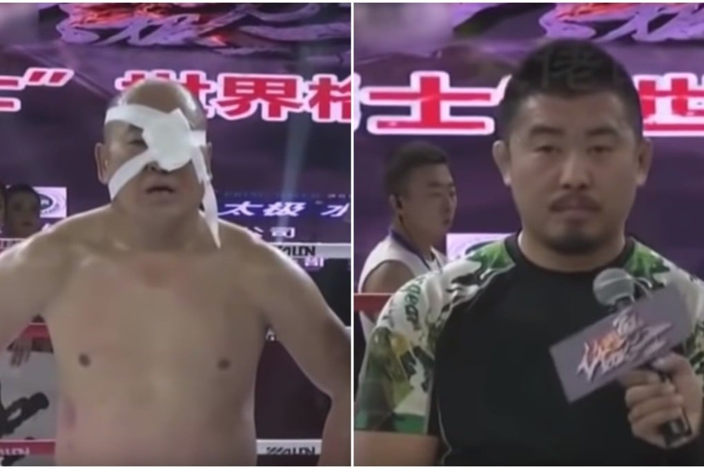 Tian Ye (left) after his battering by Xu Xiaodong. Photos: YouTube