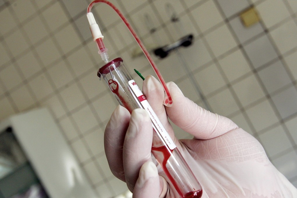 File photo of a test-tube with HIV-positive blood. Photo: AFP