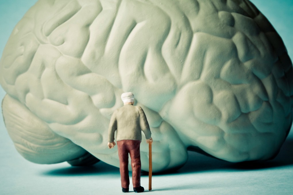 Aggressive treatment to lower blood pressure in older people has been shown to cut the risk of developing mild cognitive impairment. Photo: Alamy