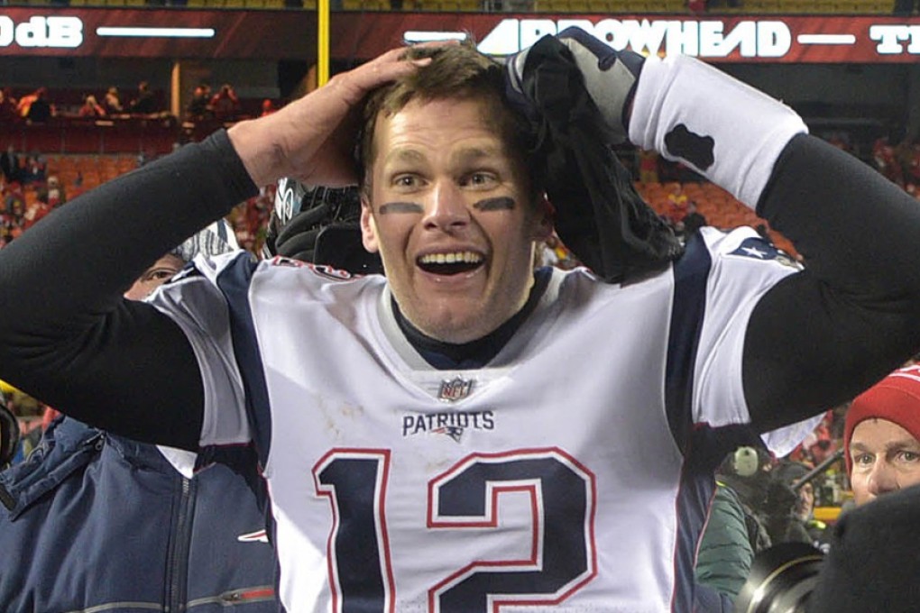 New England Patriots quarterback Tom Brady does a lot of weird things to stay in peak shape. Photo: USA TODAY Sports