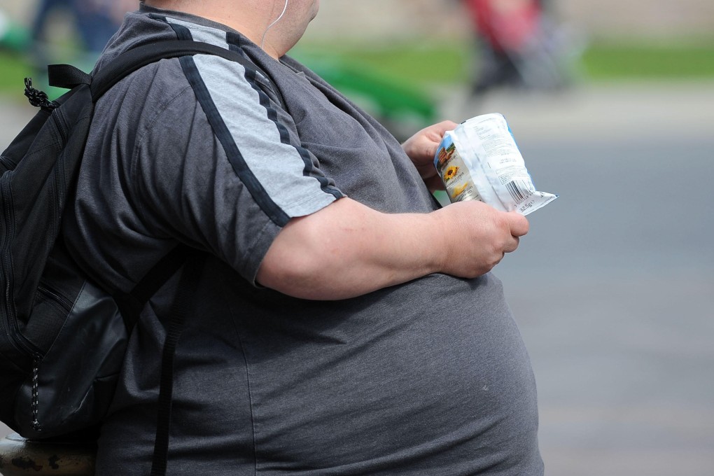Obesity should be considered a disease rather than a symptom of sloth and human self-indulgence, according to the The Lancet report on the Great Global Syndemic. Photo: Alamy