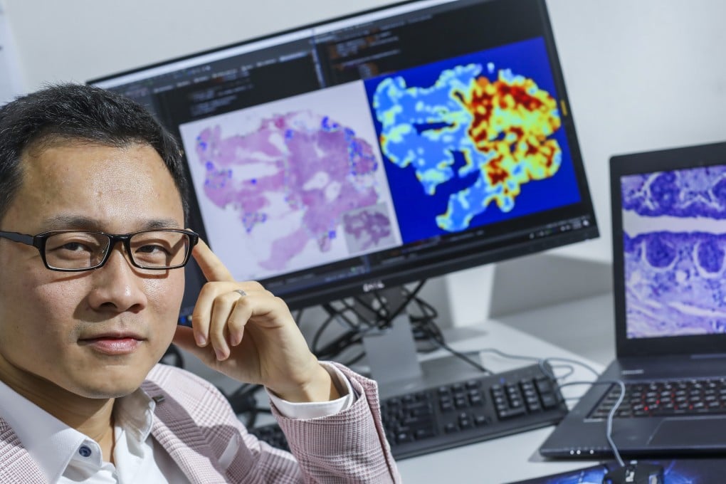 Over the past several years, Scotty Kwok Chun-ho has entered six international competitions that use artificial intelligence to study digital images to solve cancer-related problems. Photo: K.Y. Cheng