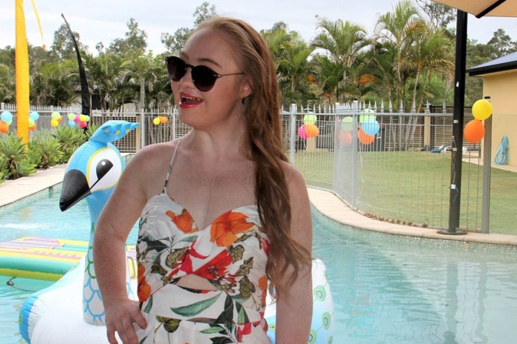 Madeline Stuart, a model with Down’s syndrome, celebrating her 22nd birthday two weeks before open-heart surgery last year. Photo: Rosanne Stuart