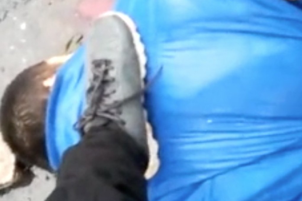 A 33-year-old man has been detained following a knife attack in east China. Photo: Weibo