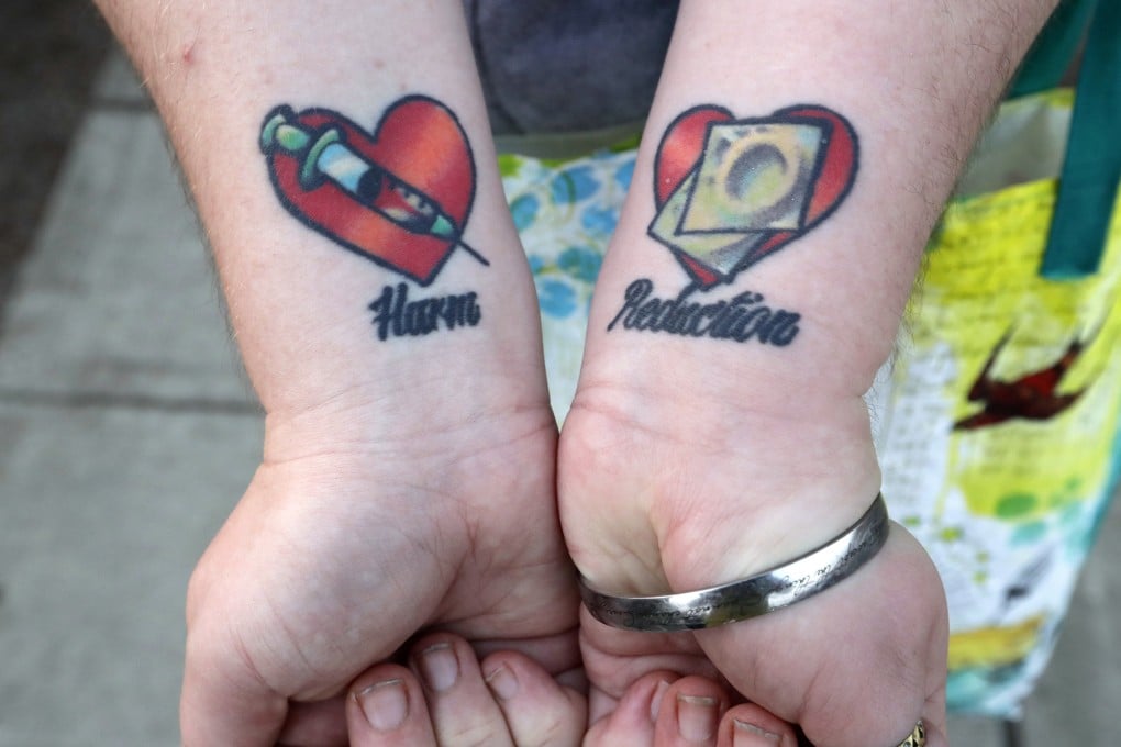 A former sex worker and trafficking survivor shows her tattoos on her forearms that read “harm reduction”. Leaving the industry in the hands of criminals and the black market only perpetuates violence against women and the degradation of sex workers. Photo: AP