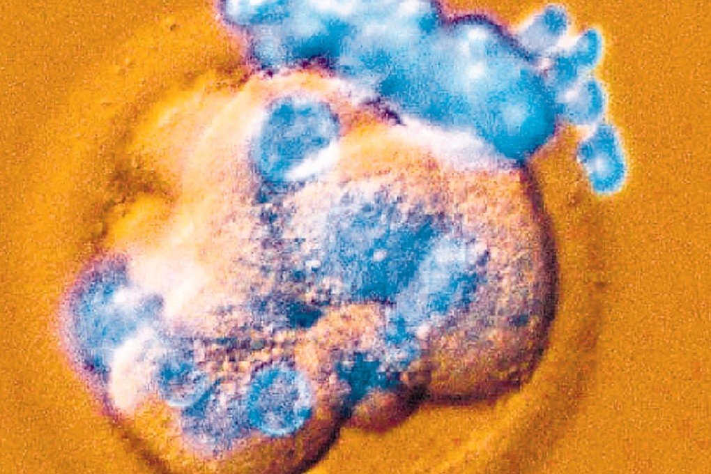 The research could eventually help grow human organs for transplant inside animal hosts. Photo: Reuters