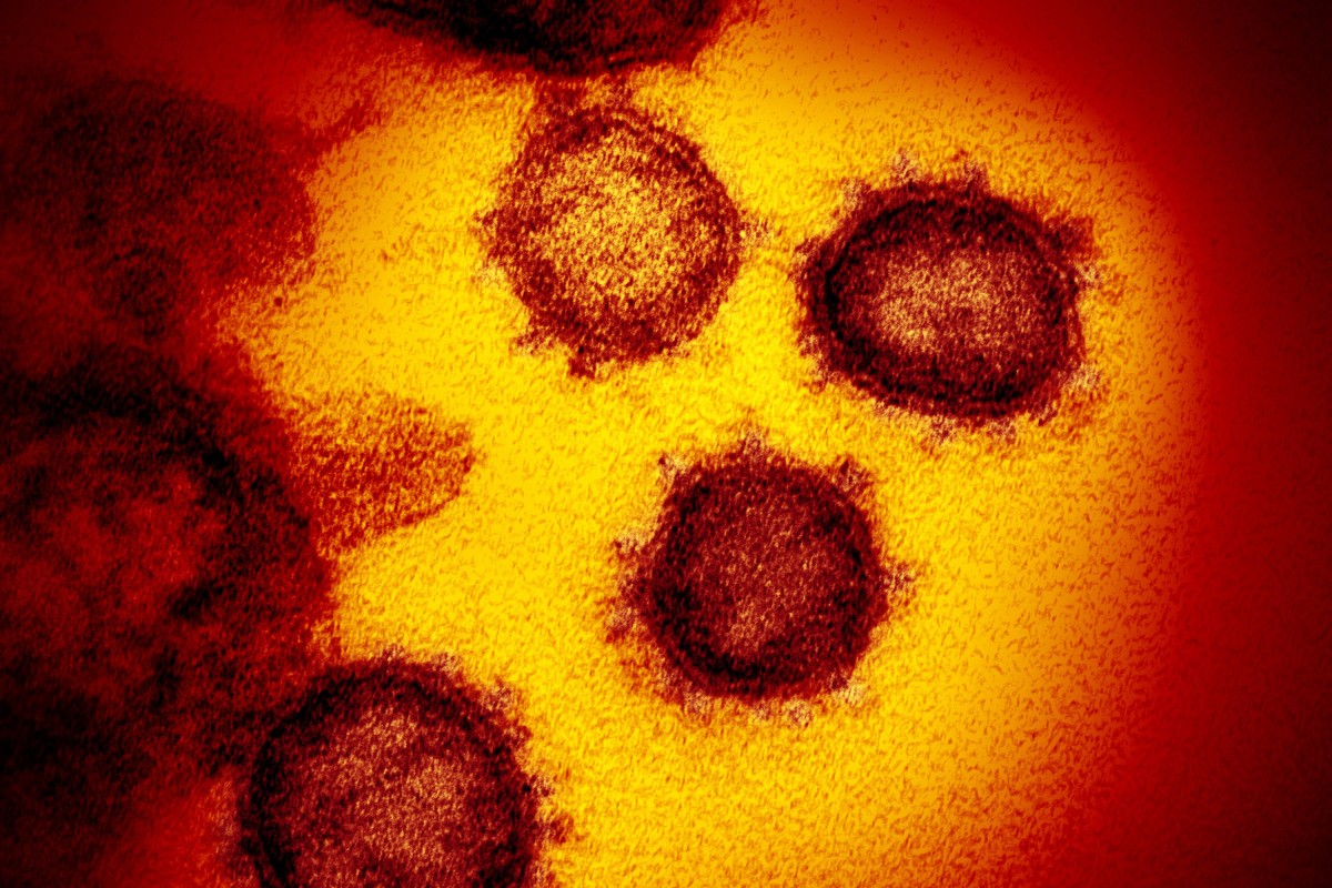 An image from an electron microscope shows SARS-CoV-2, the virus that causes COVID-19. Photo: NIAID-RML/Zuma Press/TNS