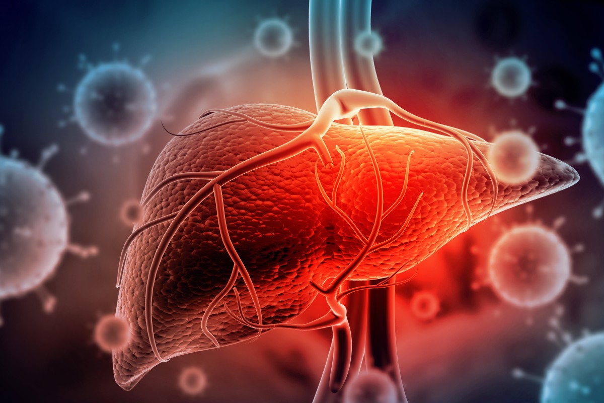 The hepatitis may be triggered by an immune response. Photo: Shutterstock