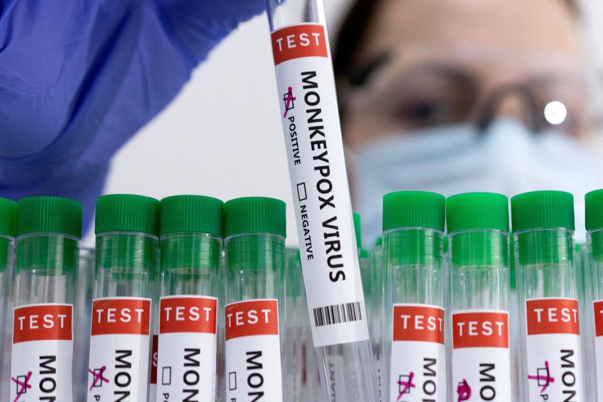The WHO says a polymerase chain reaction (PCR) test is the “preferred laboratory test given its accuracy and sensitivity”. Photo illustration: Reuters