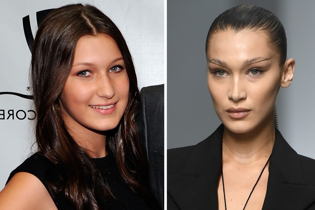 Bella Hadid – pictured at a benefit concert in Las Vegas, in 2010, then at Mugler’s women’s spring/summer 2020 ready-to-wear collection fashion show in Paris, in September 2019 – is rumoured to have undergone buccal fat removal. Photos: AFP, Getty Images
