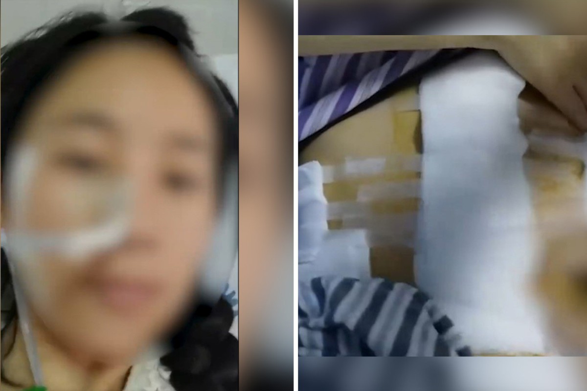 A woman in China has been left needing to wear a colostomy bag for the rest of her life after a string of violent attacks by her husband over a two-year period. Photo: SCMP composite/Weibo