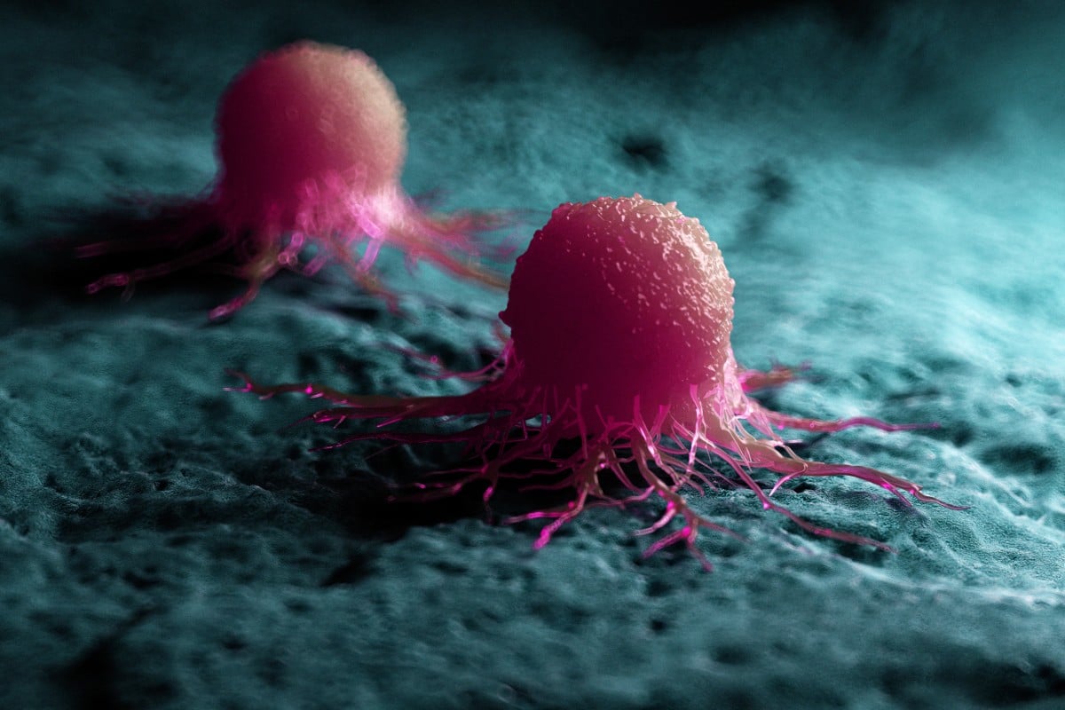 Scientists turn tumors into ‘pork’ in radical cancer treatment