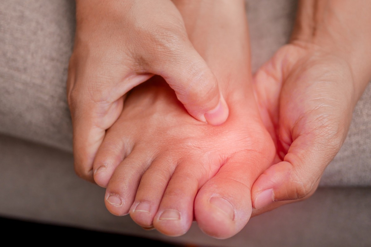 Woman admits trying to sell human toes she found in dog vomit
