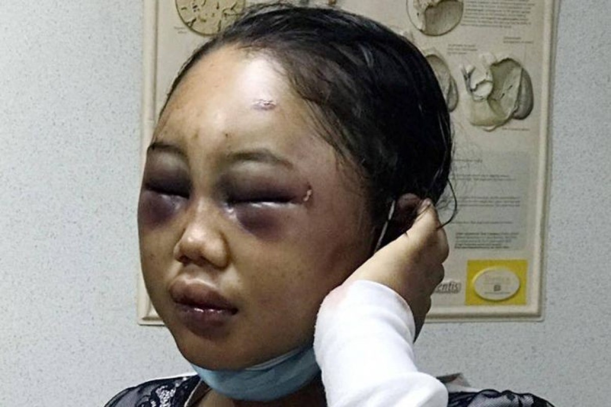 Suyanti Sutrinso. Photo: The Straits Times