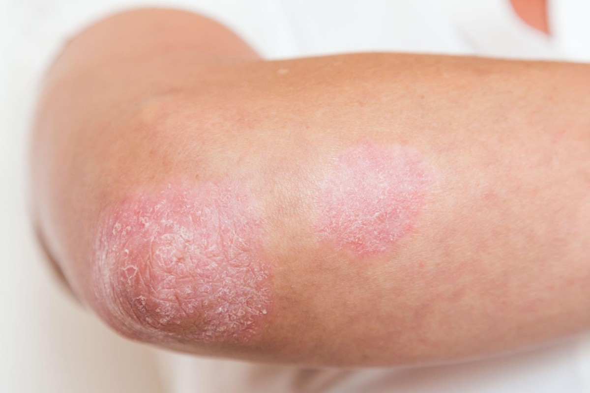 From Diabetes To Pancreatic Cancer When An Itch Is A Symptom Of From Diabetes To Pancreatic Cancer When An Itch Is A Symptom Of