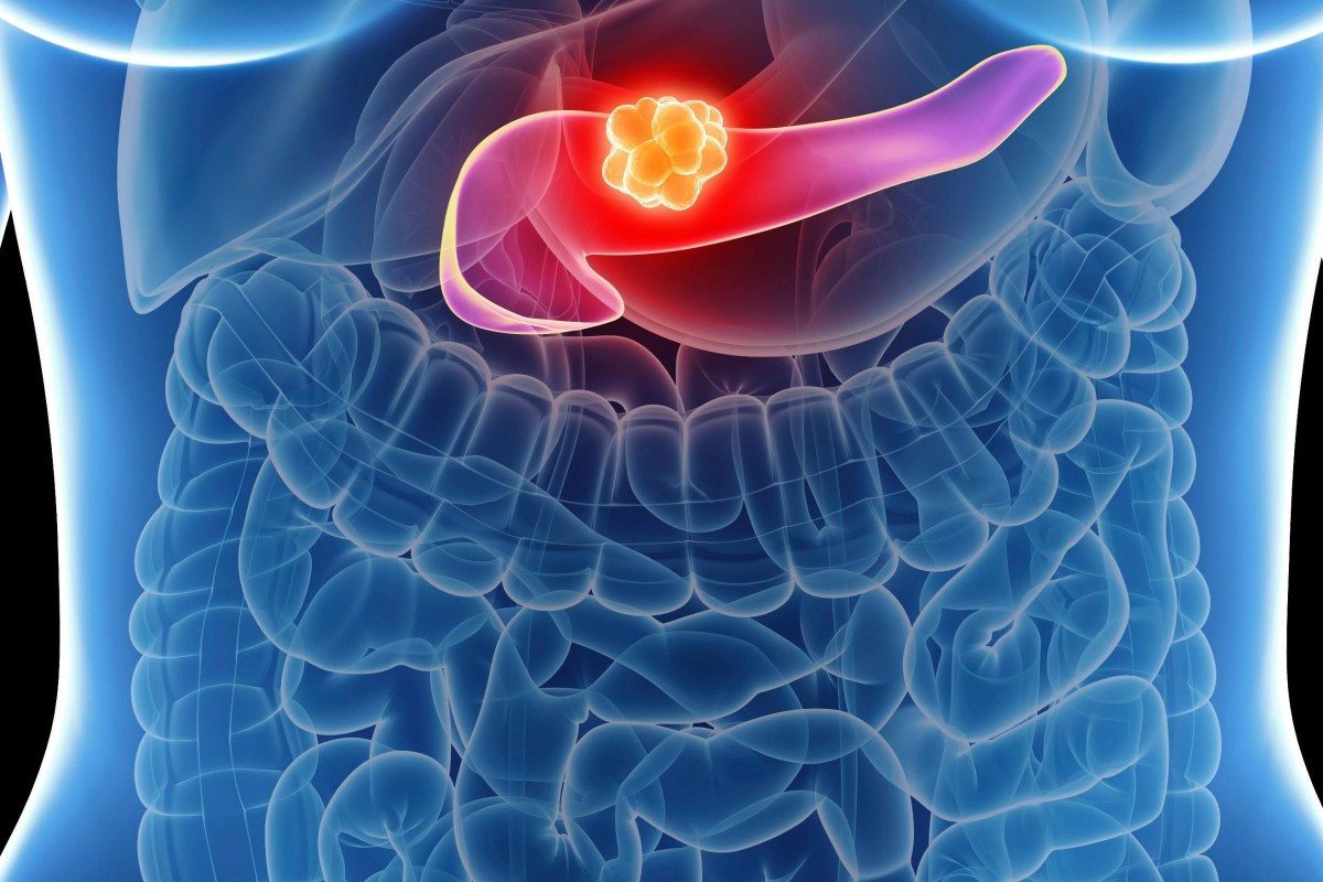 Overlooked Brain Cells May Have Leading >> Heading In Football Damages Nerve Cells In The Brain According To A Overlooked Brain Cells May Have Leading >> Heading In Football Damages Nerve Cells In The Brain According To A