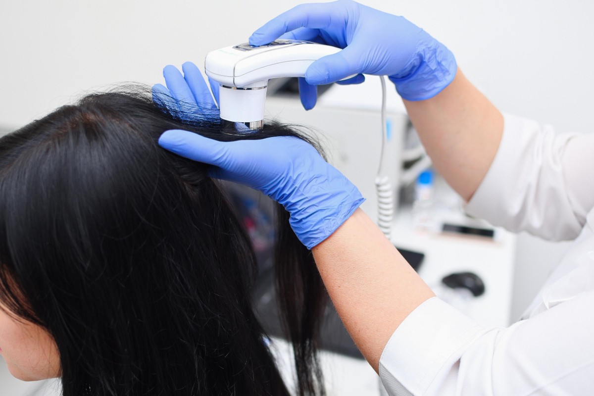 Studies and polls suggest stress leading to hair loss is a big health concern in China. Photo: Alamy