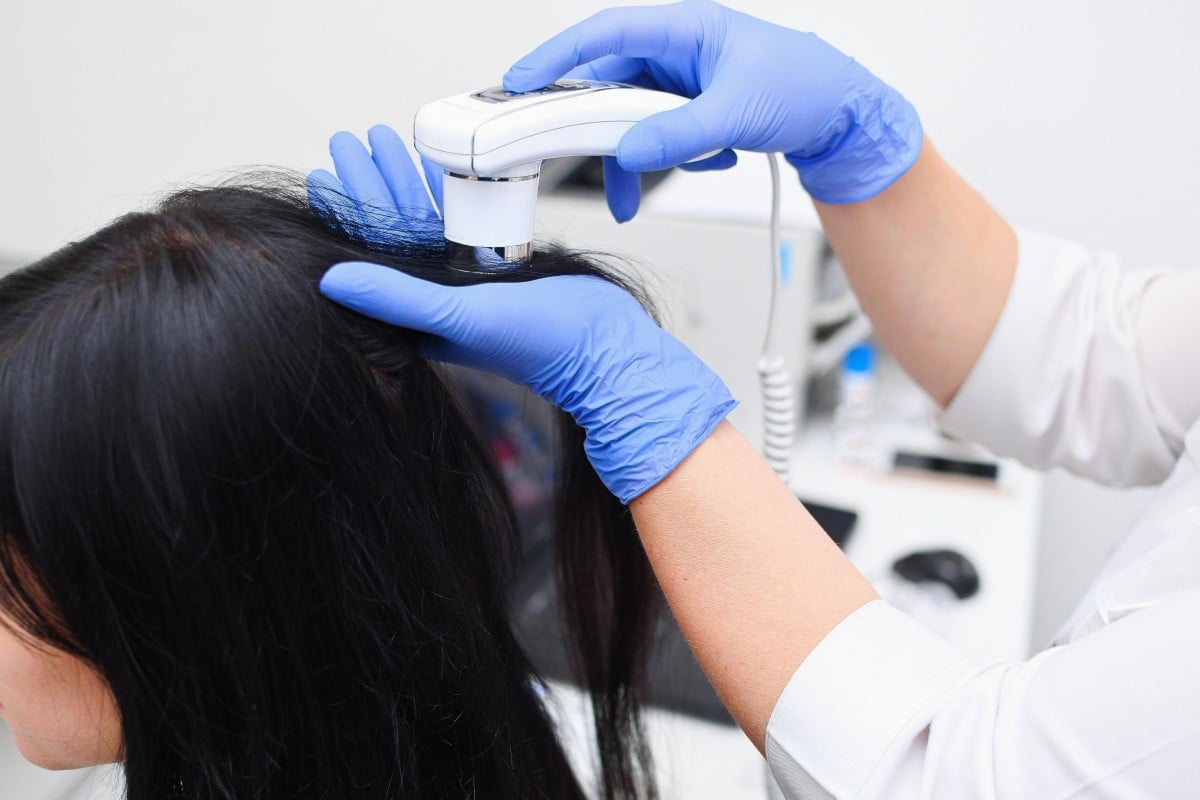 Studies and polls suggest stress leading to hair loss is a big health concern in China. Photo: Alamy