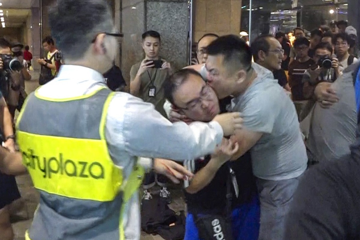 Un consigliere distrettuale che si è staccato una parte dell'orecchio domenica sera si sta riprendendo da un intervento chirurgico.  Foto: Dispensa
