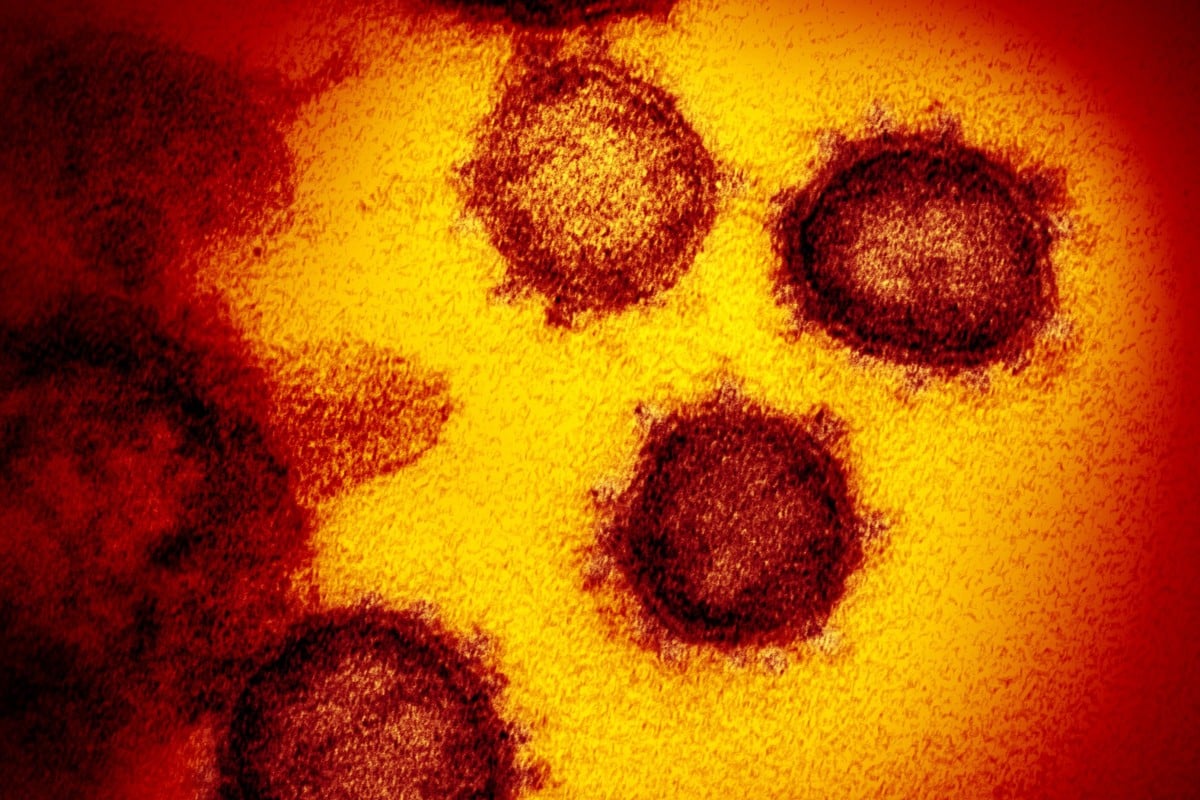 Coronavirus: HIV-like mutation