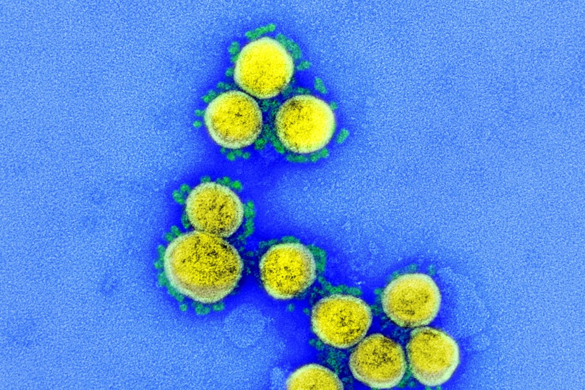 Coronavirus Mutation Becomes urgent Concern As It Dominates Across 