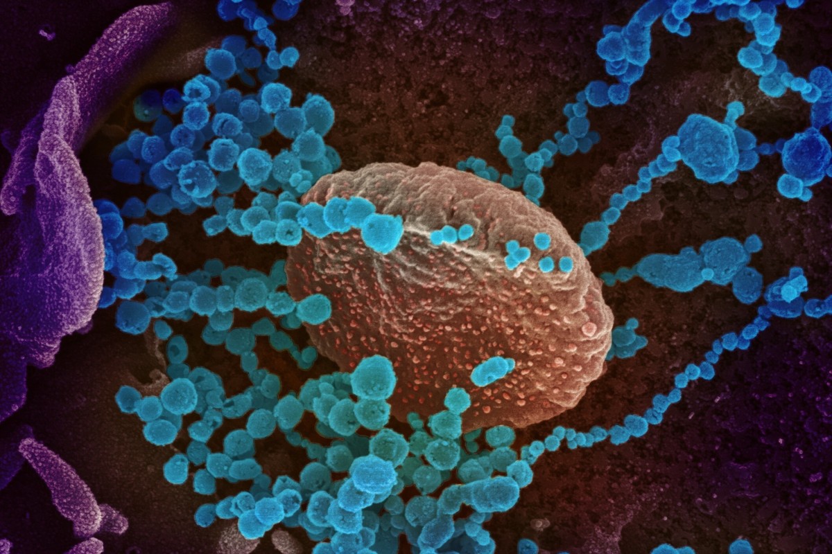 A scanning electron microscope image shows the round blue coronavirus emerging from cells. Scientists around the world are working on antibody treatments. Photo: EPA-EFE