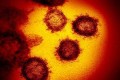 Microscope images of Sars-CoV-2, the virus that causes Covid-19. Photo: TNS