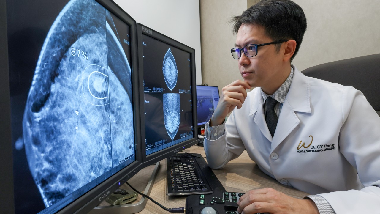 AI软件如何帮助检测乳腺癌，尤其是早期癌症，通过加快治疗来挽救更多生命——医生解释其价值和潜力