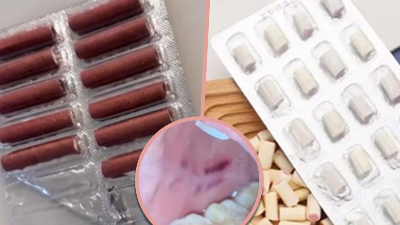 Chinese woman injured after mistaking firecracker for candy