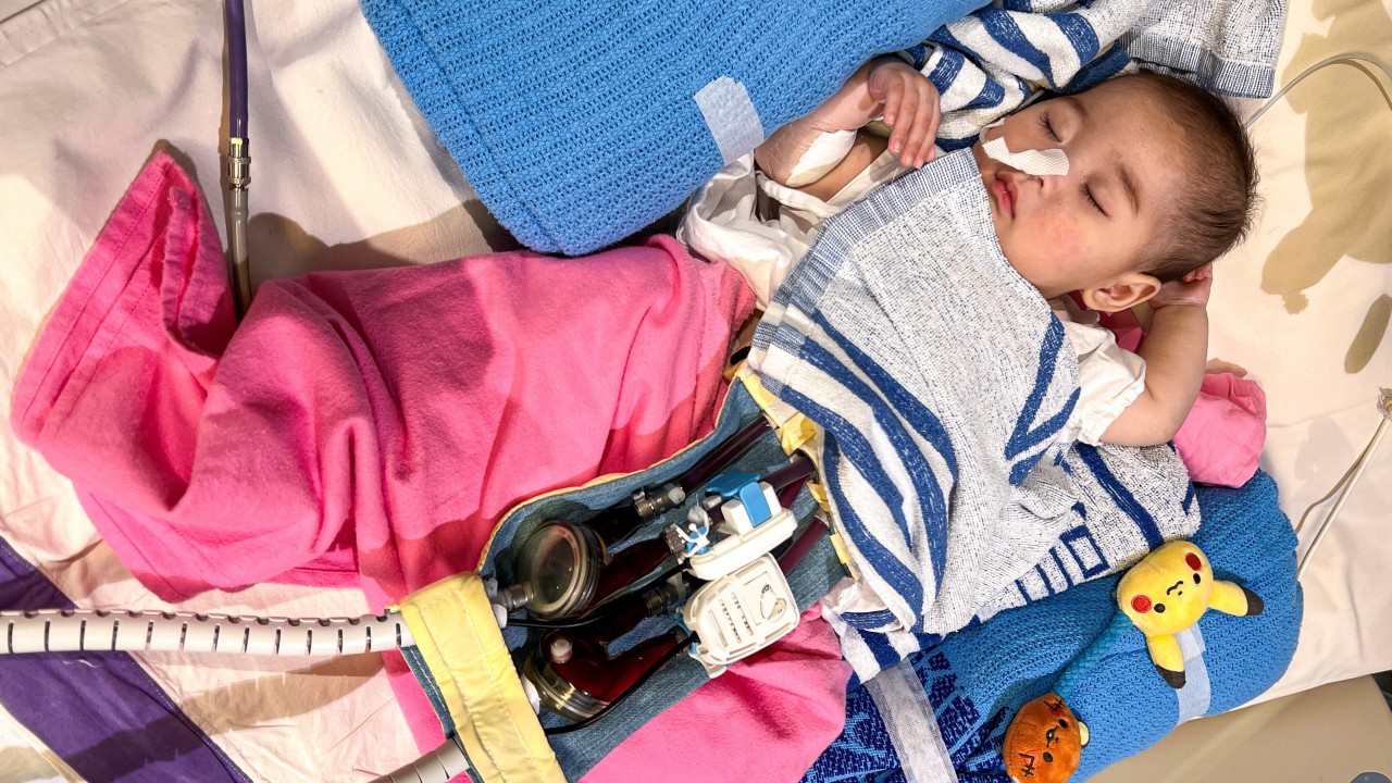 After heart transplant in Hong Kong, 8-month-old Whitney’s condition stabilises