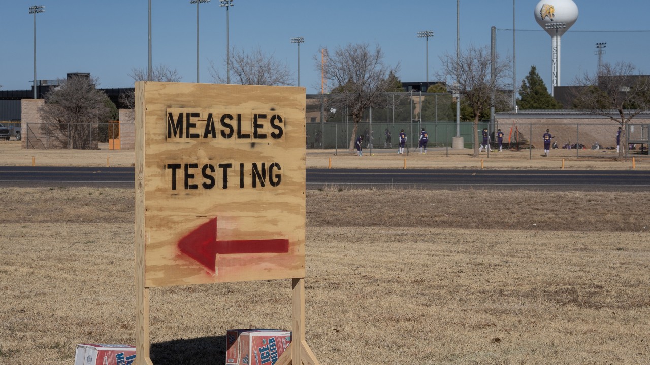 500 cases in West Texas measles outbreak as second child dies