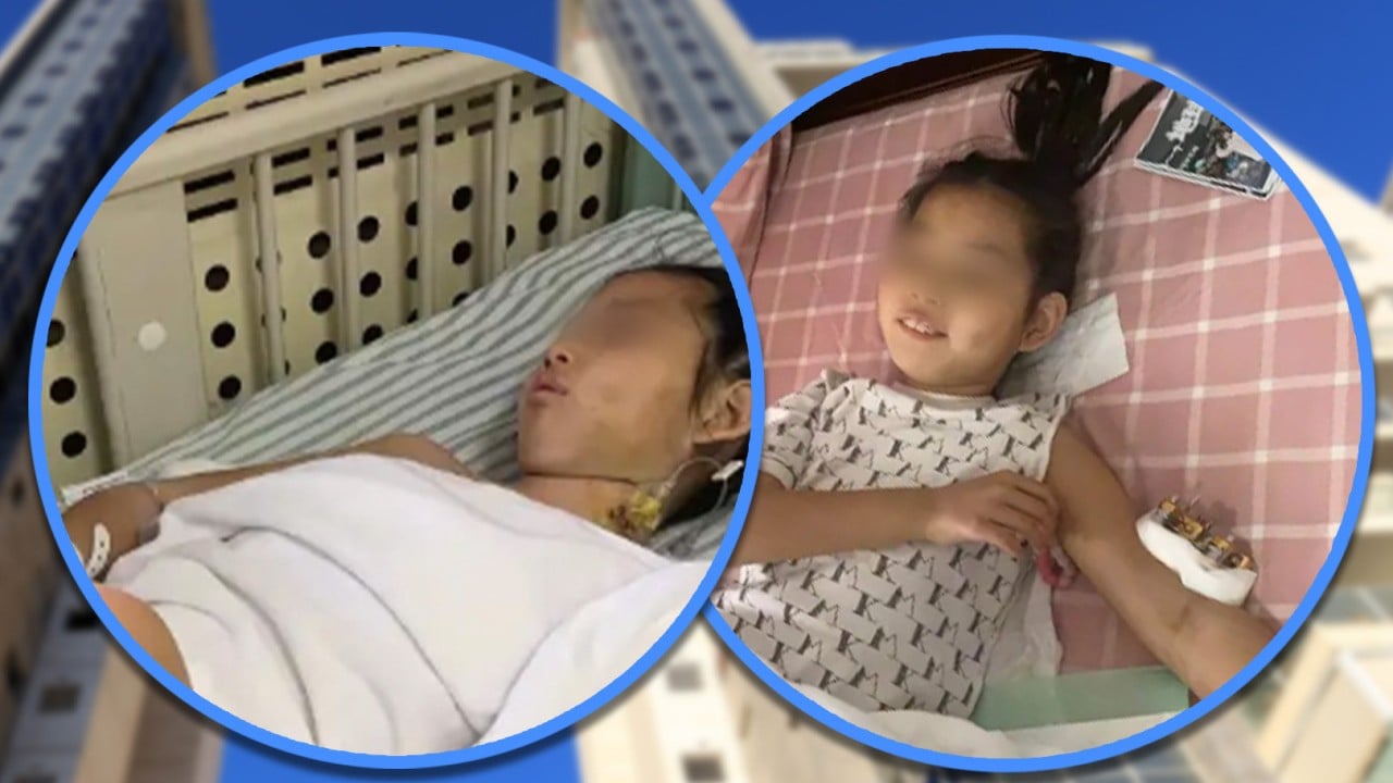 China ‘miracle’ girl survives 25th-floor fall, lands on platform, suffers only bone fractures