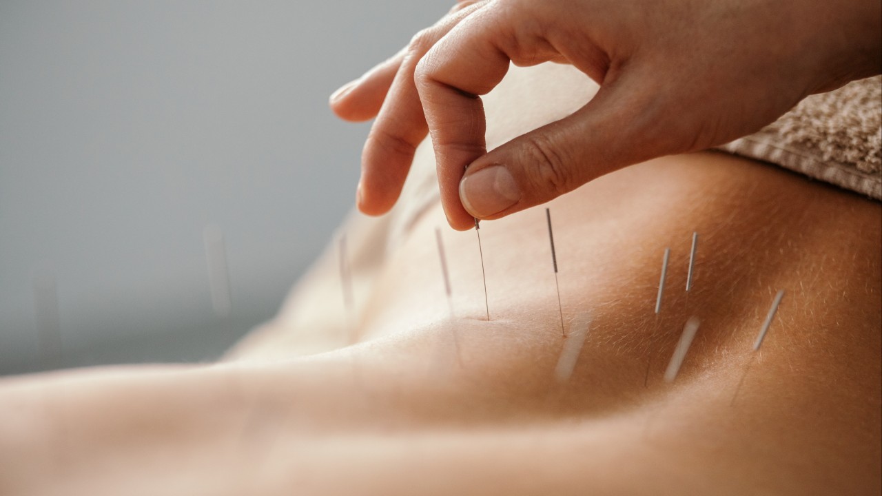 Is acupuncture safe in Hong Kong, and how to avoid ‘flesh-eating’ infection?