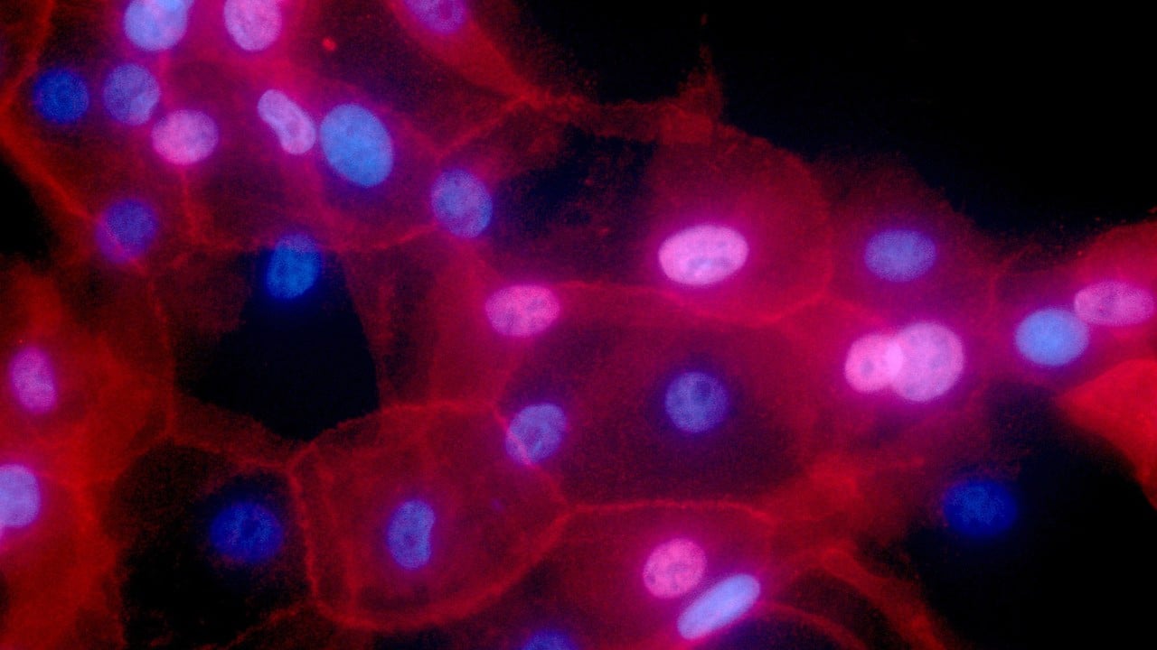Chemotherapy can speed up cancer spread, Chinese study finds