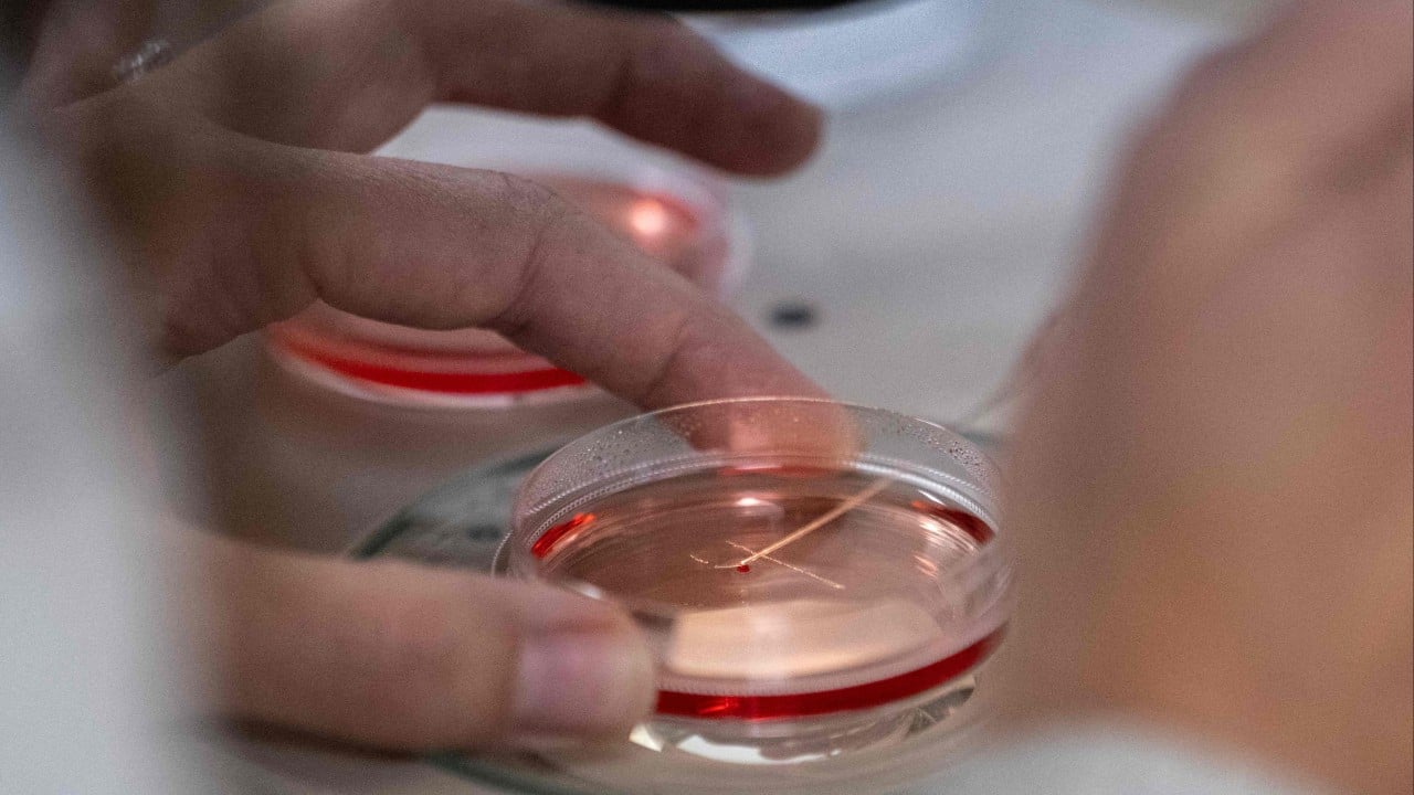 Israeli Sheba Hospital Grows Lab Kidneys Surviving 34 Weeks, Seeks China Funding