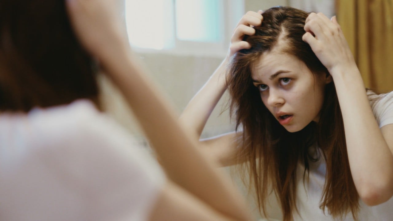 Losing your hair? Why that might be and how to stop it – and even regrow it