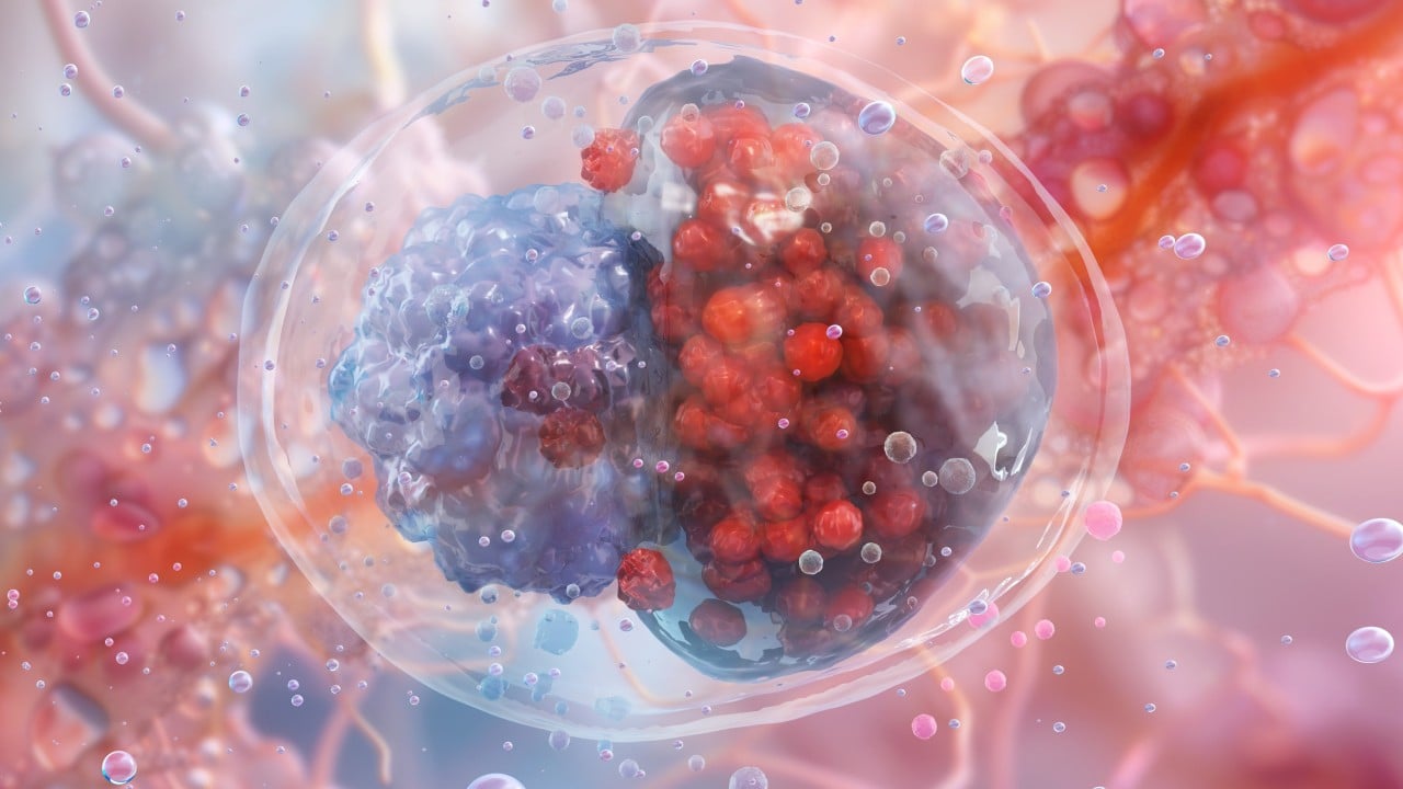 What is chlamydia? The ‘silent STI’ that can cause infertility if untreated