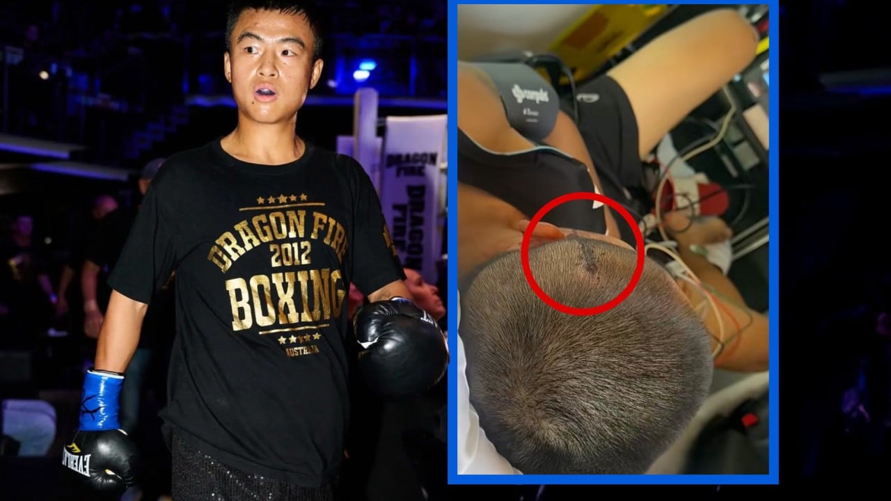 China boxer survives Australia attack, divorces wife over failure to protect her